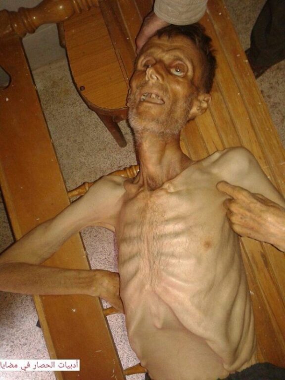 Barack Obama Is Complicit With Assad Siege of Madaya