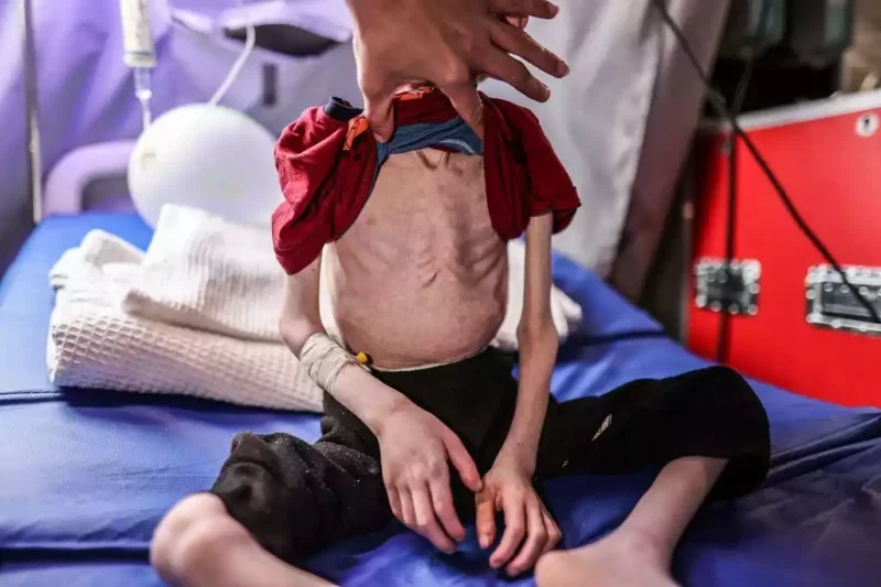 The ICJ Orders Israel to Stop Starving Children
